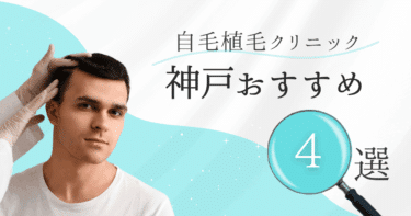 神戸の自毛植毛クリニックおすすめ4選【後悔しない選び方も徹底解説】